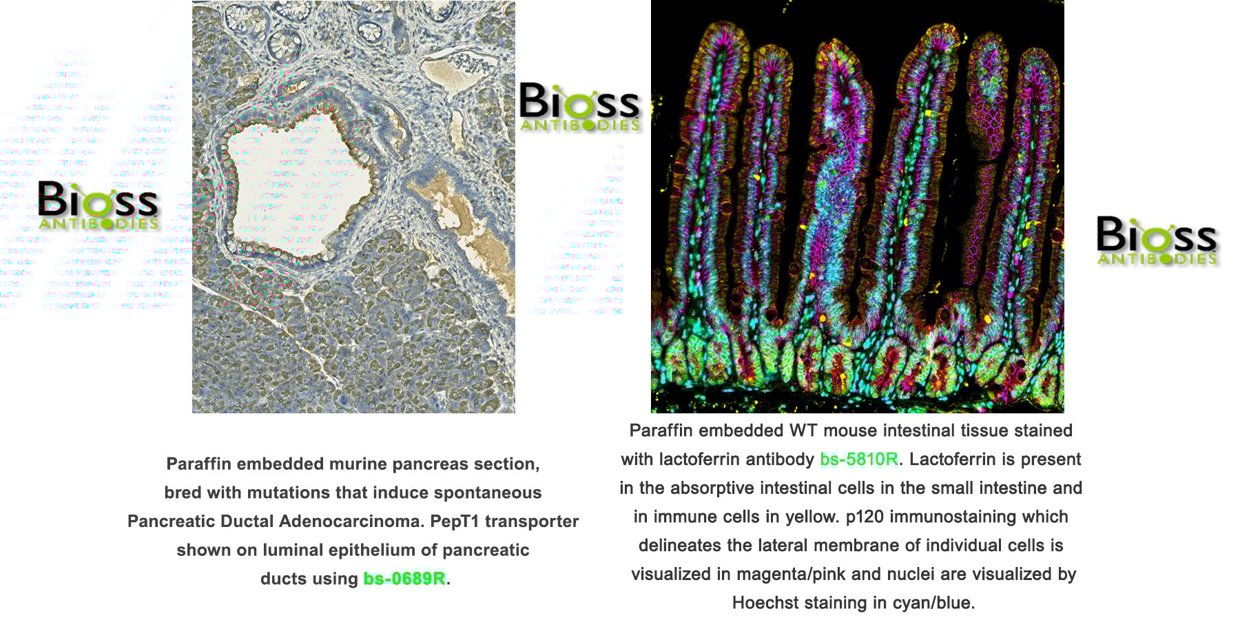 Technical Tips for Antigen Retrieval
